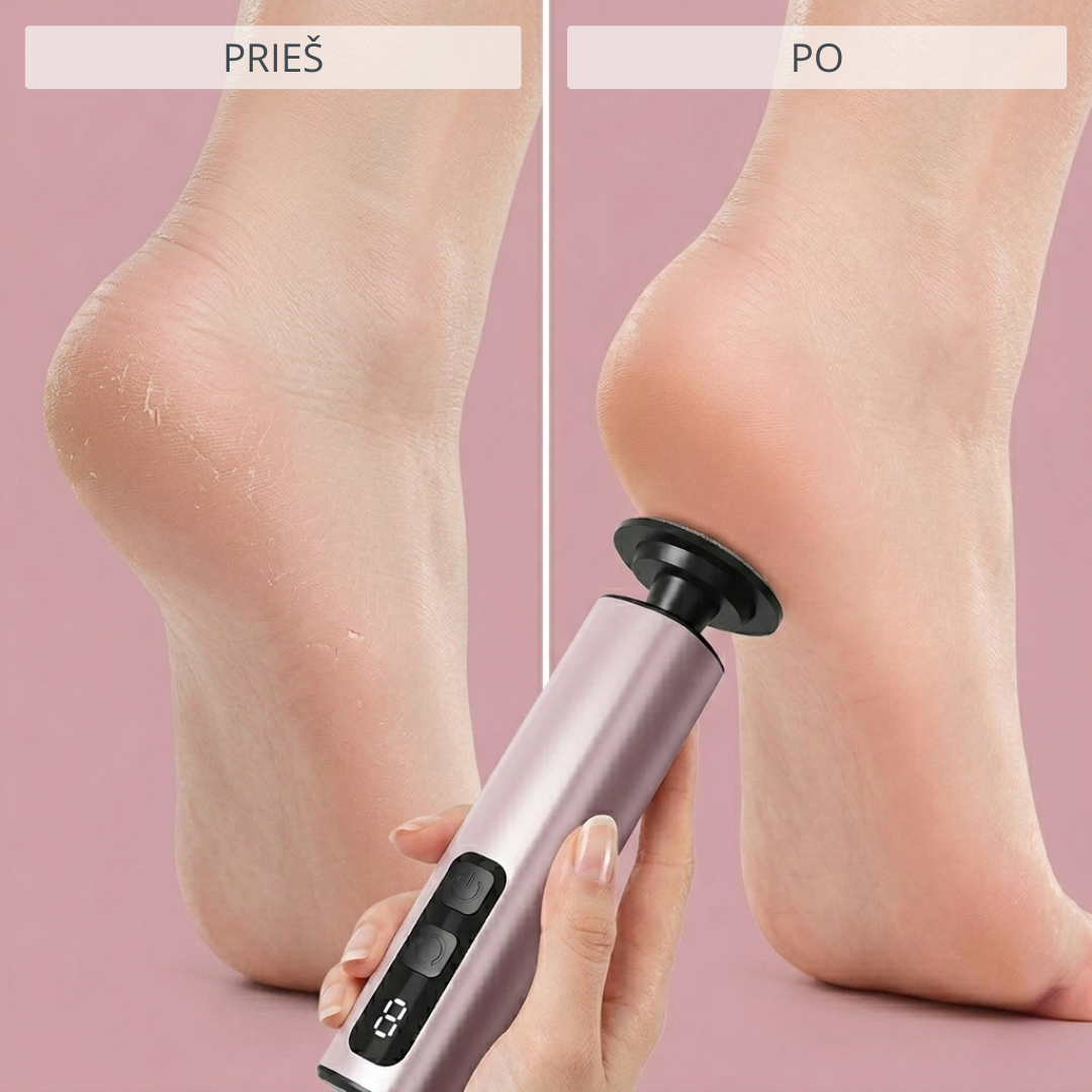 Elektrinis pėdų šveitiklis ELIYA Smooth - Image 5