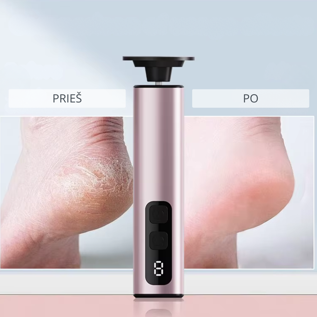 Elektrinis pėdų šveitiklis ELIYA Smooth - Image 4