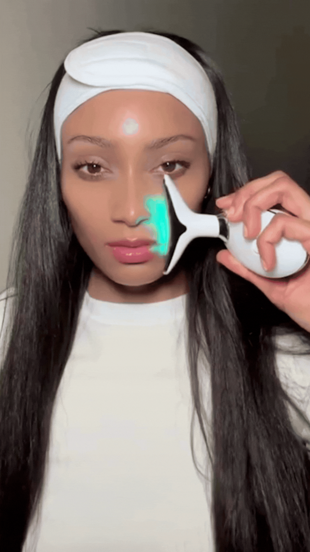 derm_facelift_img_13