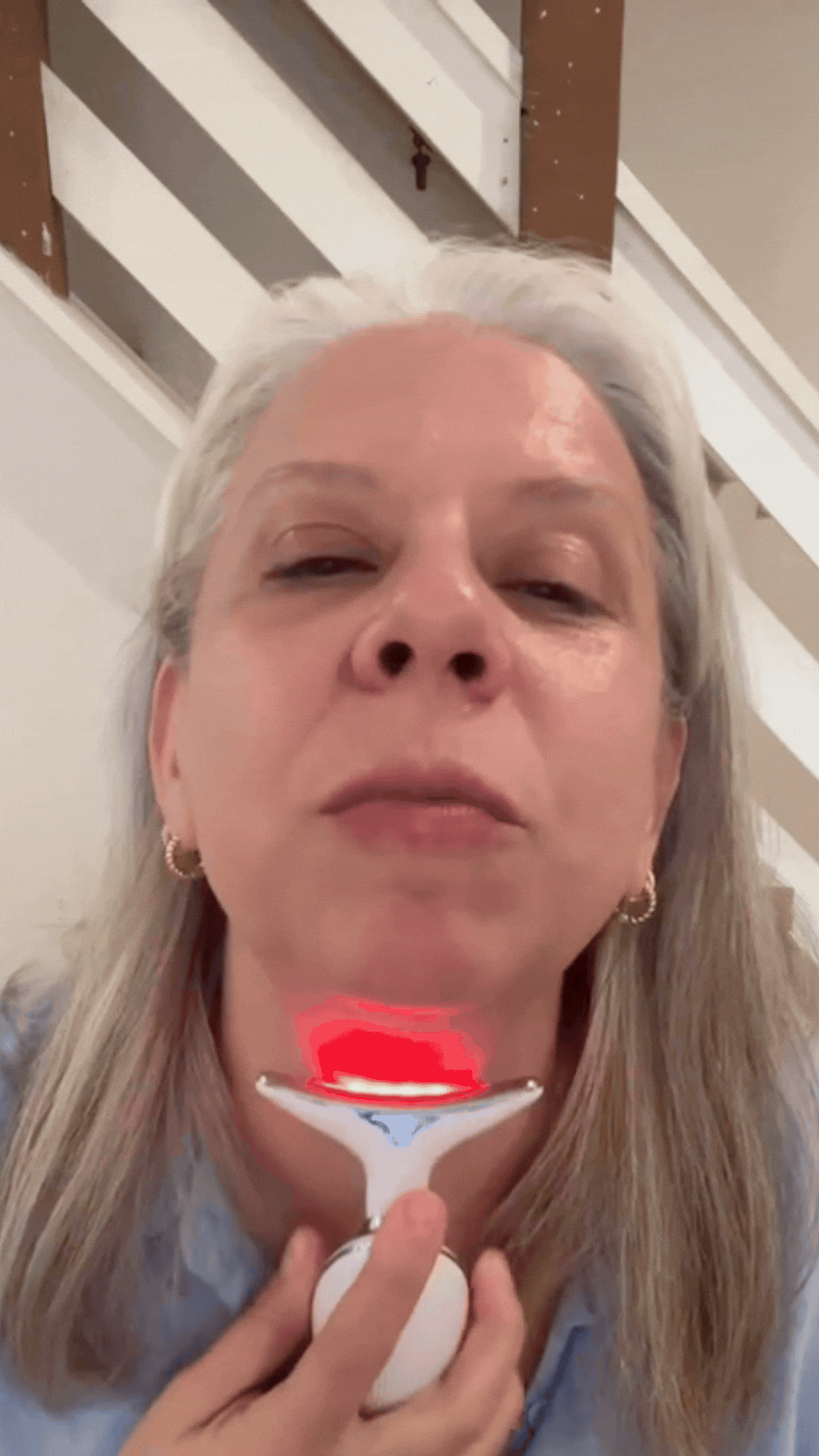 derm_facelift_img_8